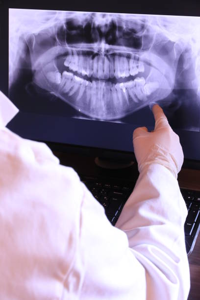 Best Emergency Dental Extractions in Cutten, CA
