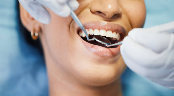 Best Emergency Root Canal Treatment in Cutten, CA