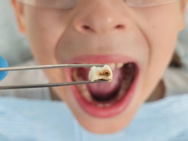 Best Mobile Emergency Dentist in Cutten, CA
